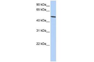 WB Suggested Anti-SIGLEC6 Antibody Titration:  0. (SIGLEC6 抗体  (C-Term))