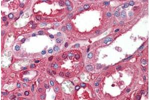 Human Kidney: Formalin-Fixed, Paraffin-Embedded (FFPE) (Albumin 抗体  (AA 108-157))