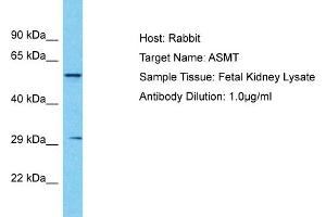 Host: Rabbit Target Name: ASMT Sample Tissue: Human Fetal Kidney Antibody Dilution: 1ug/ml