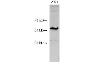 Western Blot analysis of A431 cell using C15orf23 Polyclonal Antibody at dilution of 1:500 (KNSTRN 抗体)