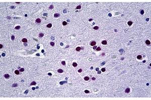 Human Brain: Formalin-Fixed, Paraffin-Embedded (FFPE) (UBR5 抗体  (AA 600-650))