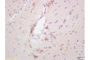 Formalin-fixed and paraffin embedded rat brain labeled with Rabbit Anti GAD65 Polyclonal Antibody, Unconjugated (ABIN668140) at 1:200 followed by conjugation to the secondary antibody and DAB staining (GAD65 抗体  (AA 501-585))