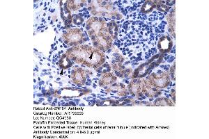 Human kidney (ZNF84 抗体  (C-Term))