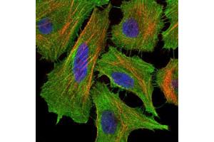 Immunofluorescence analysis of Hela cells using FAS antibody (green). (FAS 抗体)