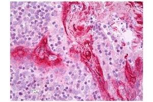 Tonsil stained with TGM1 antibody Cat. (TGM1 抗体)