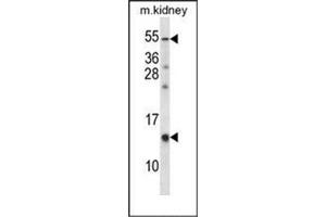 Western blot analysis of RAMP3 Antibody  in Mouse kidney tissue lysates (35ug/lane). (RAMP3 抗体  (C-Term))