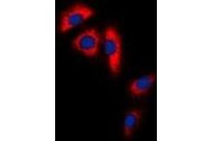 Immunofluorescent analysis of Aconitase 1 staining in Hela cells. (Aconitase 1 抗体  (N-Term))