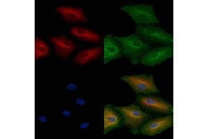 ABIN6264551 and ABIN6272407 staining  cells by IF/ICC. (RAB11FIP4 抗体  (Internal Region))