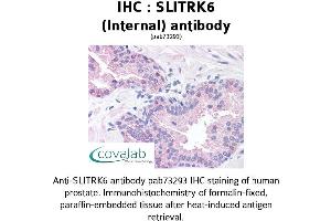 Image no. 2 for anti-SLIT and NTRK-Like Family, Member 6 (SLITRK6) (Internal Region) antibody (ABIN1739441) (SLITRK6 抗体  (Internal Region))