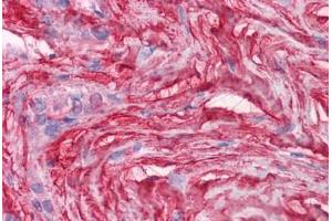 Human Soft tissue: Formalin-Fixed, Paraffin-Embedded (FFPE) (Decorin 抗体  (AA 1-360))