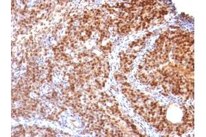 Formalin-fixed, paraffin-embedded Rat Ovary stained with SUMO-2 MAb (SUMO2/1199) (SUMO2 抗体)