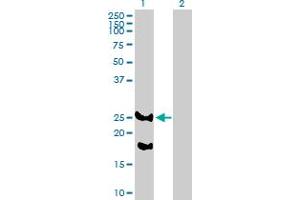 Western Blot analysis of REEP2 expression in transfected 293T cell line by REEP2 MaxPab polyclonal antibody. (REEP2 抗体  (AA 1-252))