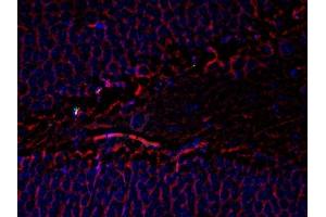 Immunofluorescence (IF) image for anti-Tubulin, beta 3 (TUBB3) antibody (ABIN371847) (TUBB3 抗体)