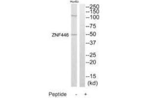 Western blot analysis of extracts from HuvEc cells, using ZNF446 antibody. (ZNF446 抗体)
