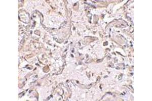 Immunohistochemical staining of human lung tissue using AP30389PU-N GSTP1 antibody at 2. (GSTP1 抗体  (Center))