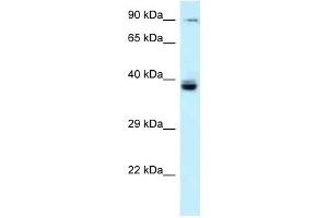 Western Blot showing TAGAP antibody used at a concentration of 1 ug/ml against Fetal Liver Lysate (TAGAP 抗体  (N-Term))