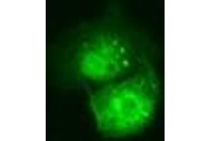 Anti-C21orf59 mouse monoclonal antibody (ABIN2452866) immunofluorescent staining of COS7 cells transiently transfected by pCMV6-ENTRY C21orf59 (RC200169). (C21orf59 抗体)