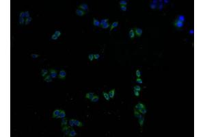 Immunofluorescence staining of Hela cells with ABIN7146439 at 1:100, counter-stained with DAPI. (CAMK2A 抗体  (AA 321-478))