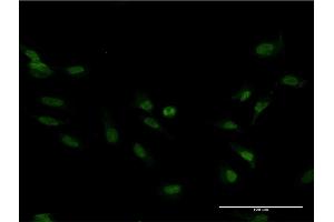 Immunofluorescence of monoclonal antibody to FOXM1 on HeLa cell. (FOXM1 抗体  (AA 22-110))