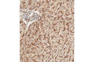 Immunohistochemistry (Paraffin-embedded Sections) (IHC (p)) image for anti-Glucosidase, Alpha, Acid (GAA) (AA 174-203), (N-Term) antibody (ABIN656475)