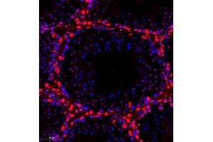 Immunofluorescence of paraffin embedded mouse testis using smad62024 (ABIN7075629) at dilution of 1:1000 (300x lens) (SMAD6 抗体)