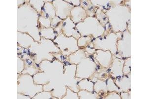IHC testing of FFPE mouse lung tissue with Csf1r antibody at 1:25 dilution. (CSF1R 抗体  (AA 895-923))