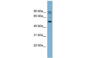 WB Suggested Anti-ZNF662 Antibody Titration:  0. (ZNF662 抗体  (Middle Region))