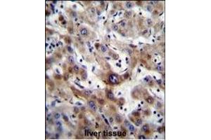 Immunohistochemistry (Paraffin-embedded Sections) (IHC (p)) image for anti-Solute Carrier Family 25 (Mitochondrial Carrier, Adenine Nucleotide Translocator), Member 6 (SLC25A6) (AA 128-155) antibody (ABIN656122)