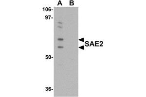 Western blot analysis of SAE2 in 293 cell lysate with SAE2 antibody at 0. (UBA2 抗体  (C-Term))