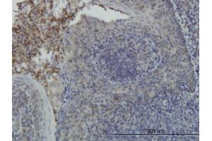 Immunoperoxidase of monoclonal antibody to RPS6KA6 on formalin-fixed paraffin-embedded human tonsil. (RPS6KA6 抗体  (AA 636-745))
