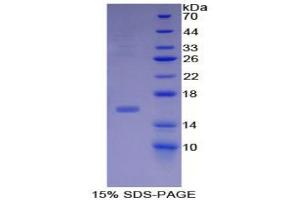 SDS-PAGE analysis of Human Inhibin beta B Protein. (INHBB 蛋白)