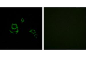 Peptide - +Immunohistochemistry analysis of paraffin-embedded human heart tissue using F13B antibody. (F13B 抗体)