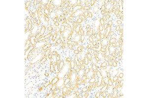 Immunohistochemistry (Paraffin-embedded Sections) (IHC (p)) image for anti-Glucosidase, Beta, Acid (GBA) antibody (ABIN7074062)