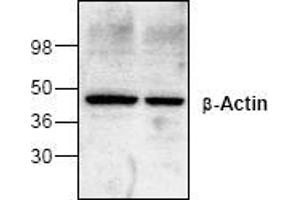 Image no. 1 for anti-Actin, beta (ACTB) antibody (ABIN127292) (beta Actin 抗体)