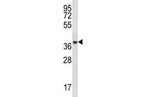 PSMA1 antibody western blot analysis in A2058 lysate. (PSMA1 抗体  (AA 234-262))