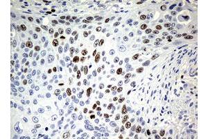 Image no. 1 for anti-Antigen Identified By Monoclonal Antibody Ki-67 (MKI67) (AA 1160-1493) antibody (ABIN1490857) (Ki-67 抗体  (AA 1160-1493))