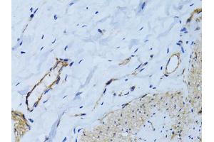 Immunohistochemistry of paraffin-embedded human colon using MCAM antibody (ABIN6290150) at dilution of 1:100 (40x lens). (MCAM 抗体)