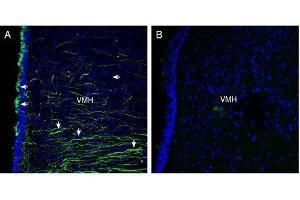 Immunohistochemistry (IHC) image for anti-Sema Domain, Immunoglobulin Domain (Ig), Transmembrane Domain (TM) and Short Cytoplasmic Domain, (Semaphorin) 4A (Sema4a) (AA 355-369), (Extracellular) antibody (ABIN7043610)