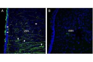 Expression of Semaphorin 4A in rat hypothalamus - Immunohistochemical staining of perfusion-fixed frozen rat brain sections with Anti-Semaphorin 4A (SEMA4A) (extracellular) Antibody (ABIN7043610, ABIN7045300 and ABIN7045301), (1:300), followed by goat anti-rabbit-Alexa-488. (Sema4a 抗体  (Extracellular, N-Term))