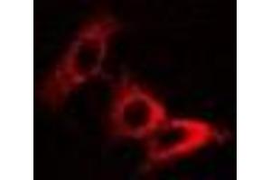 Immunofluorescent analysis of Pyridoxal Kinase staining in U2OS cells. (PDXK 抗体)