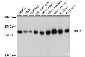 Western blot analysis of extracts of various cell lines using SDHB Polyclonal Antibody at dilution of 1:1000. (SDHB 抗体)