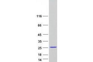 Western Blotting (WB) image for Vacuolar Protein Sorting 29 (VPS29) (Transcript Variant 1) protein (Myc-DYKDDDDK Tag) (ABIN2735423)