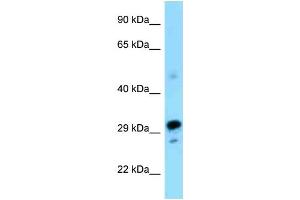 WB Suggested Anti-Nrbf2 Antibody Titration: 1. (NRBF2 抗体  (N-Term))