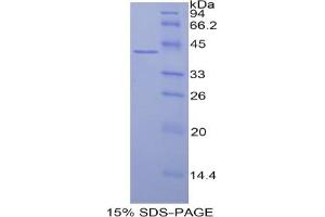 SDS-PAGE analysis of Human Histone Cluster 3, H2a Protein. (HIST3H2A 蛋白)