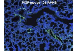Immunofluorescence staining (green) of mouse lung tissue (ED18) with anti-Mouse PlGF Antibody Cat. (PLGF 抗体  (AA 24-158))