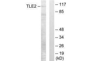 TLE2 抗体