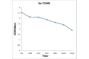 Antigen: 2 µg/100 µL  Primary: Antiserum, 1:500, 1:1000, 1:2000, 1:4000, 1:8000, 1:16000, 1:32000;  Secondary: HRP conjugated Rabbit Anti-Goat IgG at 1: 5000;  TMB staining Read the data in Microplate Reader by 450nm. (SPON1 抗体  (AA 741-807))