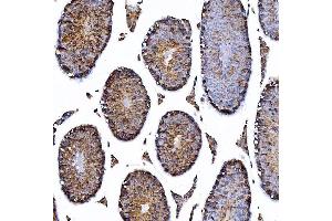 IHC analysis of HGS using anti-HGS antibody (ABIN7601206).