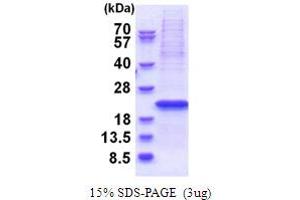 SDS-PAGE (SDS) image for Yip1 Interacting Factor Homolog B (YIF1B) (AA 1-156) protein (His tag) (ABIN5853712) (YIF1B Protein (AA 1-156) (His tag))