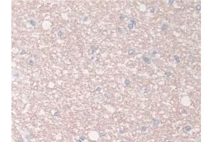 Immunohistochemistry (IHC) image for anti-Breast Cancer Anti-Estrogen Resistance 1 (BCAR1) (AA 1-240) antibody (ABIN7436351)
